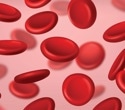 Fanconi anemia patients show striking metabolic differences