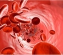 Exclusive licensing agreement accelerates PHD inhibitor development for anemia in CKD patients