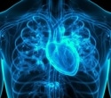 New ACC Scientific Statement highlights inflammation in cardiovascular disease