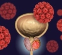 Landmark prostate cancer screening trial launches in the UK