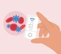 Digital patient records improve survival in HIV treatment clinics