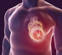 Clonal hematopoiesis linked to increased heart disease risk in cancer patients receiving treatment