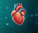 AI enables rapid detection of coronary microvascular dysfunction from standard EKGs