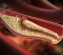 Successful root canal treatment benefits metabolic and heart health