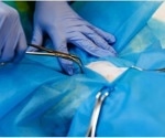 New hot-melt tissue adhesive can heal operative wounds