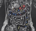 Research reveals how the gut microbiome supports successful pregnancy