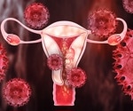 Modern pollutants and ancient genetic variants could explain why some women develop endometriosis