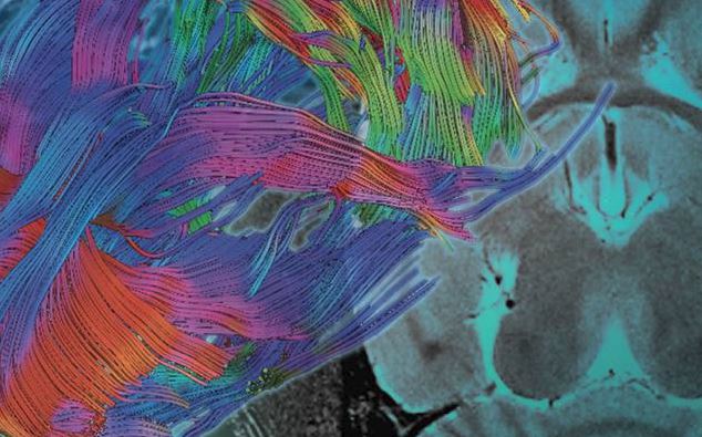 In vivo Magnetic Resonance Imaging